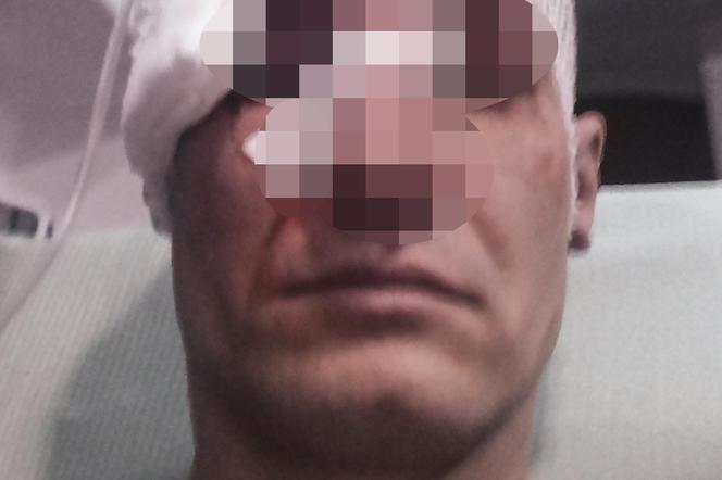 Szambiarz pobił klienta