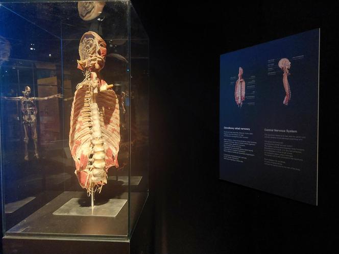 Wystawa Body Worlds w Szybie Wilson w Katowicach