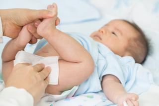 Pieluszkowe zapalenie skóry: co robić, gdy niemowlak ma czerwoną pupę?