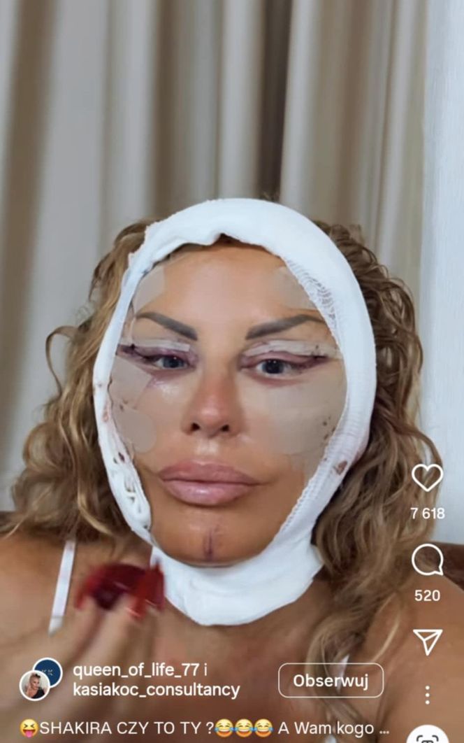 Dagmara Kaźmierska miała operację plastyczną