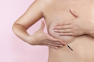 Operacje plastyczne piersi. Zabiegi pomniejszenia, podniesienia, powiększenia piersi