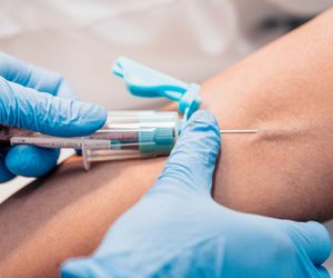 Gazometria: wyniki i normy pH krwi