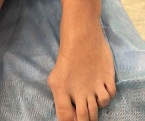 Chorzów. Innowacyjny zabieg u dziecka przeprowadzony po raz pierwszy na Śląsku