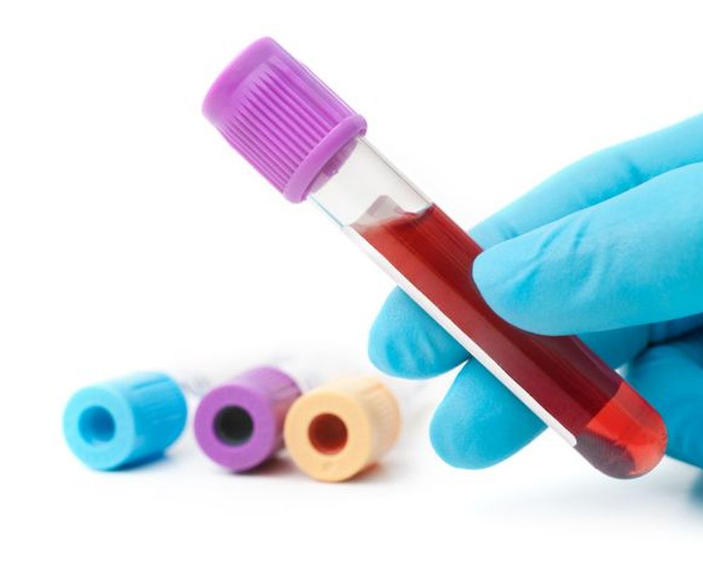 Nadmiar beta-globulin we krwi może świadczyć o chorobach nerek, ostrym uszkodzeniu wątroby.