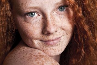 Piegi i przebarwienia na twarzy - zapobieganie i usuwanie