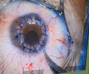 To pierwsza taka operacja na świecie. W Katowicach.