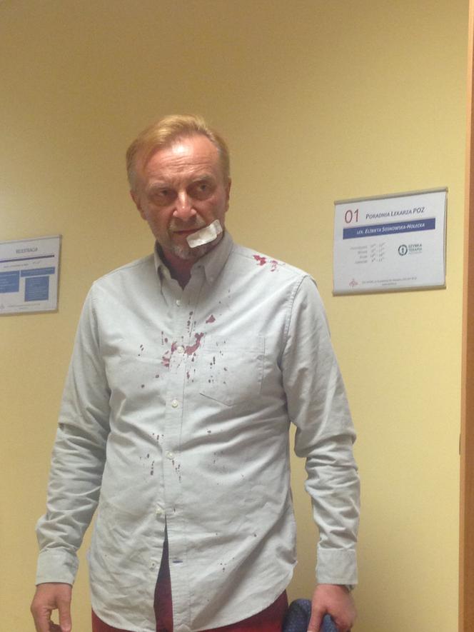 Pobiła go bo czuła się molestowana?