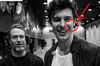 Shawn Mendes ma bliznę na twarzy. Zrobił mu ją fan krótko przed koncertem w Krakowie