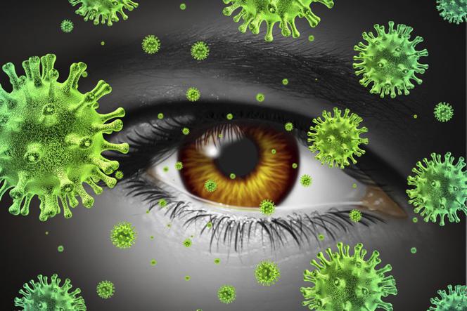 ZAPALENIE SPOJÓWEK wywołane przez bakterie, wirusy lub grzyby