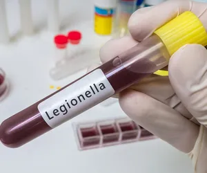 Legionella w Łodzi! Trzy przypadki zakażenia w województwie łódzkim