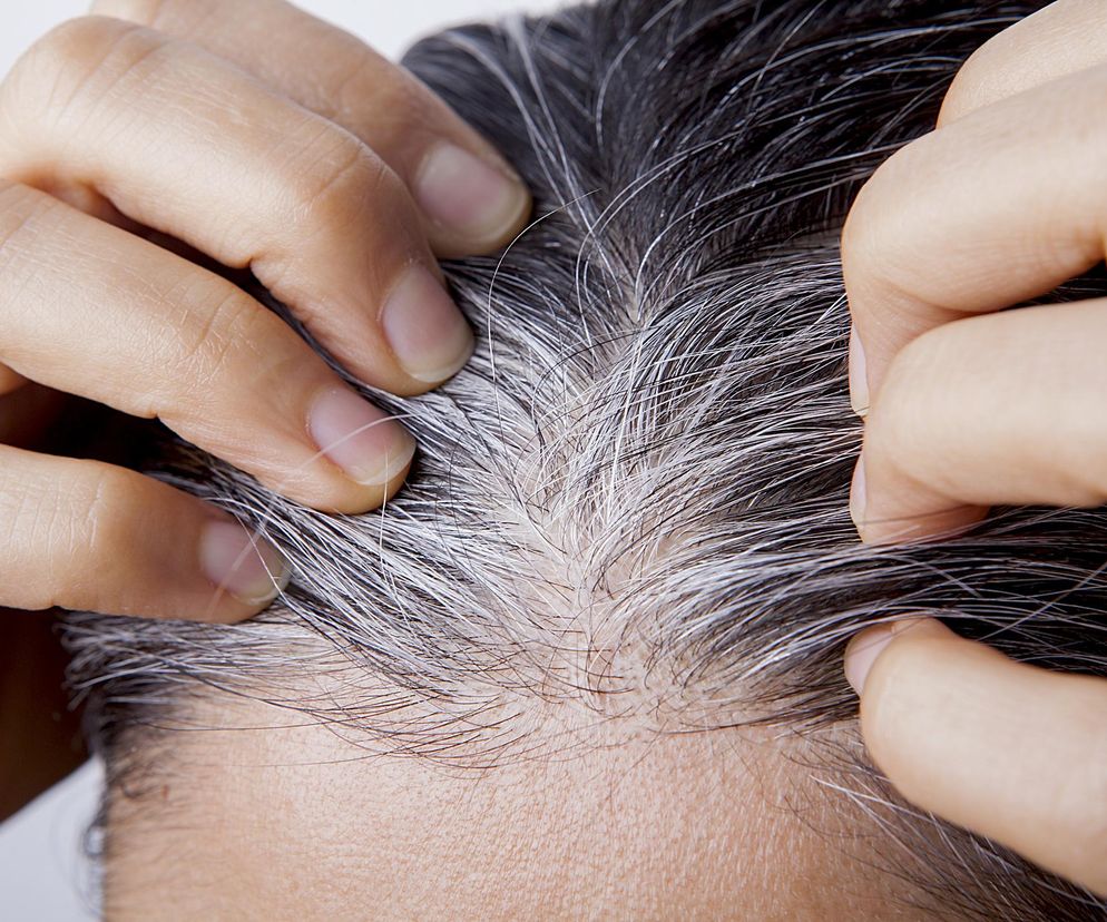 Jak cofnąć siwienie włosów? Naukowcy odkryli na to sposób