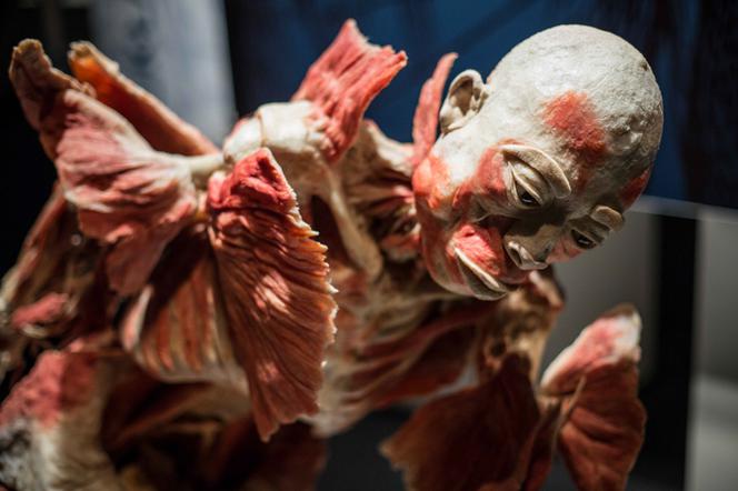 Bodies Revealed