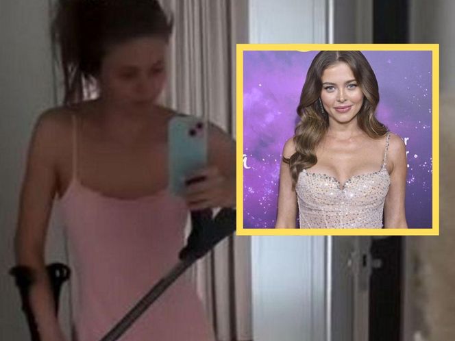 Joanna Opozda dwa miesiące po operacji