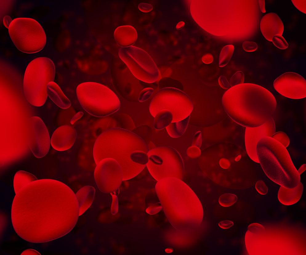 Zapalenie naczyń chłonnych: przyczyny, objawy, leczenie