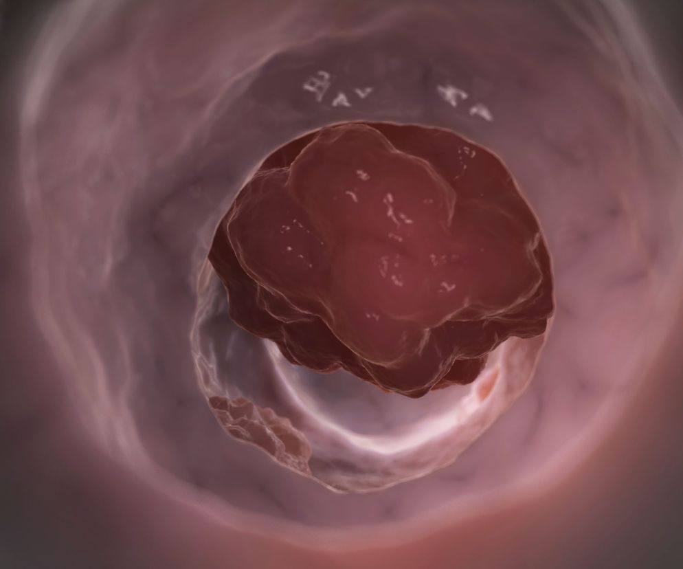 Rektoskopia to badanie polegające na wziernikowaniu kanału odbytu i odbytnicy.