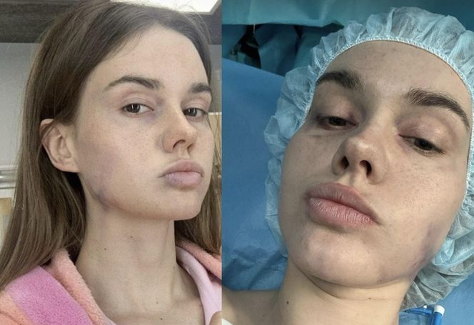 M jak miłość. Zmasakrowana Franka w szpitalu! Żona Pawła będzie walczyła o życie w nowym sezonie  - ZDJĘCIA