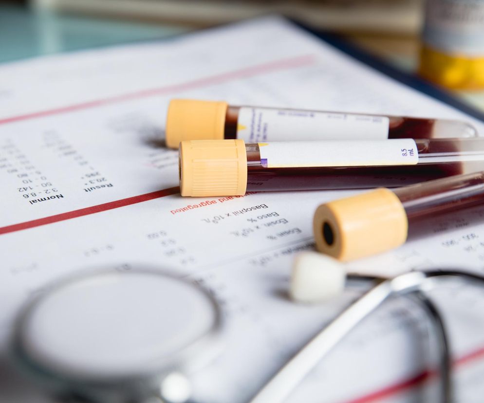 Masz za sobą covid? Zgłoś się do lekarza po skierowanie na te badania