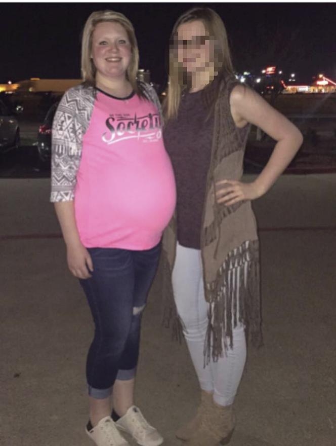 Wycięła dziecko z brzucha przyjaciółki! Matka i synek NIE ŻYJĄ