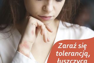 Zaraź się tolerancją, łuszczycą nie możesz - Światowy Dzień Chorych na Łuszczycę