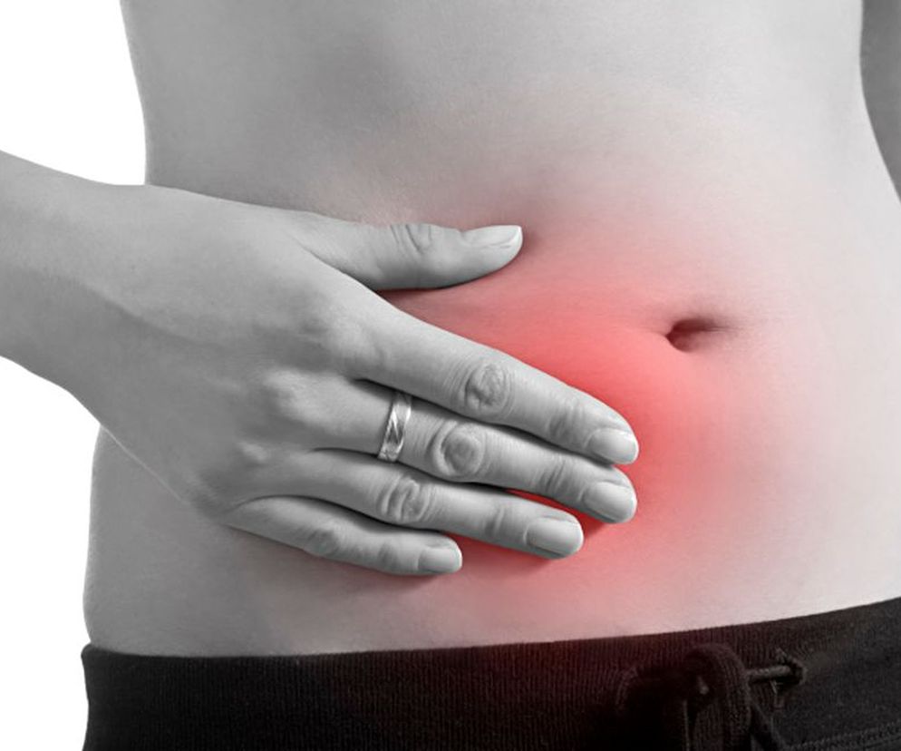 Przepuklina nigdy nie znika sama, wcześniej czy później konieczna będzie operacja przepukliny. Nieleczona przepuklina może zaś narazić nas na niebezpieczne powikłania, zagrażające życiu. Nie czekaj więc z operacją przepukliny. Sprawdź, dlaczego warto zdecydować się jak najwcześniej na leczenie przepukliny i jakie powikłania dzięki temu cię ominą.