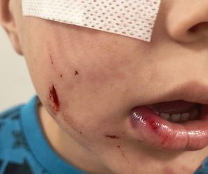 Pogryziony Franek potrzebuje pomocy. Policja szuka właściciela psa. Do szpitala dotarła anonimowa wiadomość