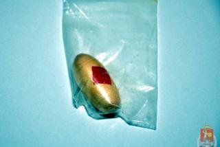 Kokaina znaleziona w brzuchu Niegeryjczyka 