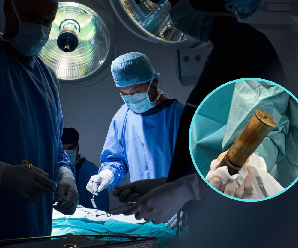 Pilna ewakuacja szpitala. 88-latek trafił na oddział z pociskiem w odbycie