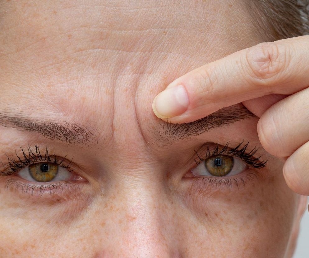 Zmarszczki na twarzy