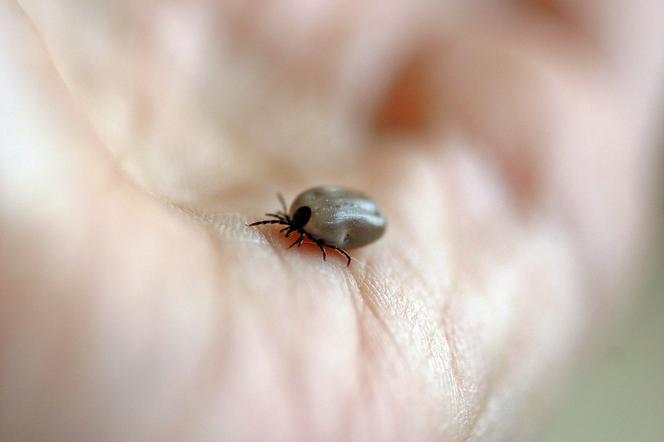 Kleszcze atakują!  Opolskie: Jest ogromne ryzyko zapalenia mózgu!