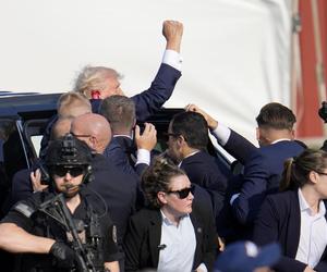 Trump przejdzie leczenie po zamachu lekarz ujawnia