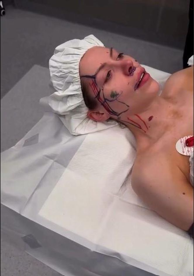 Julia von Stein operacja 