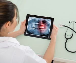 Złamanie żuchwy - objawy, leczenie, powikłania