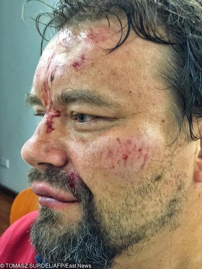 Pobili dziennikarza GW