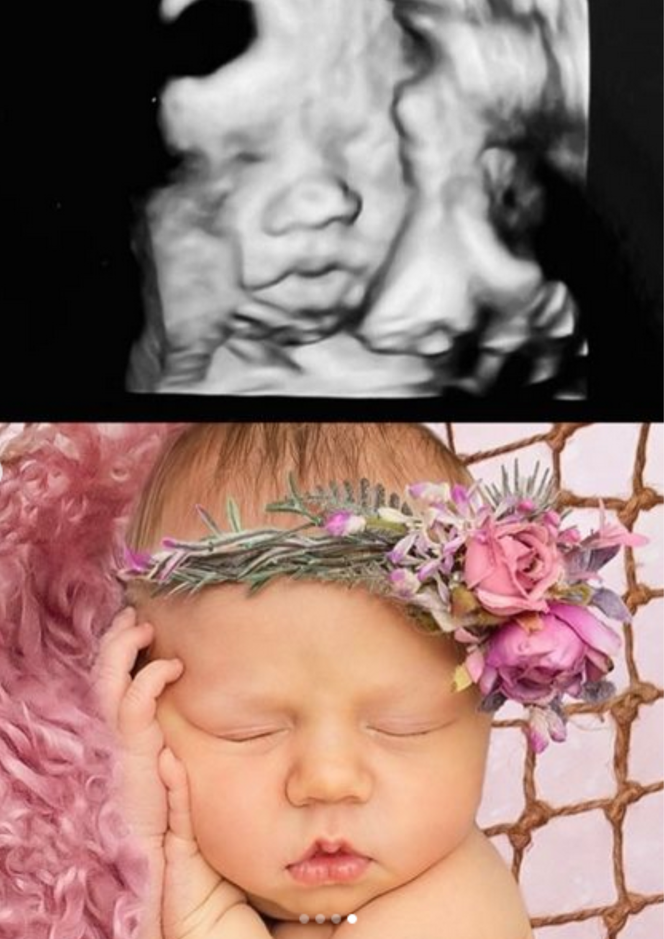 Lili Antoniak porównuje zdjęcia córeczki z USG i po urodzeniu 
