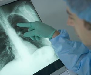 Ziarniniak kwasochłonny: przyczyny, objawy, leczenie