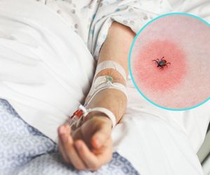 Kleszcze niebezpieczne przez cały rok. Uważaj szczególnie teraz 