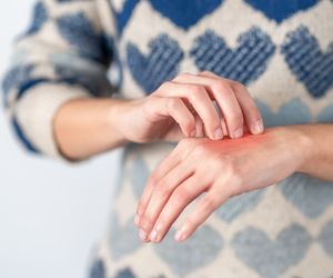 HISTAMINA - rola w organizmie, uczulenie, występowanie w żywności