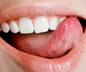 Rak ślinianki - ryzyko wystąpienia rośnie wraz z wiekiem