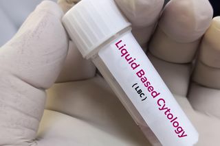 Cytologia płynna - nowoczesna technika diagnostyki raka szyjki macicy