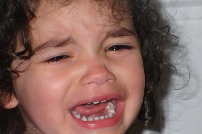 Ucierpiała 2,5-letnia dziewczynka