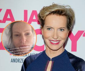 Paulina Smaszcz trafiła do szpitala. Ciężka choroba dała się we znaki