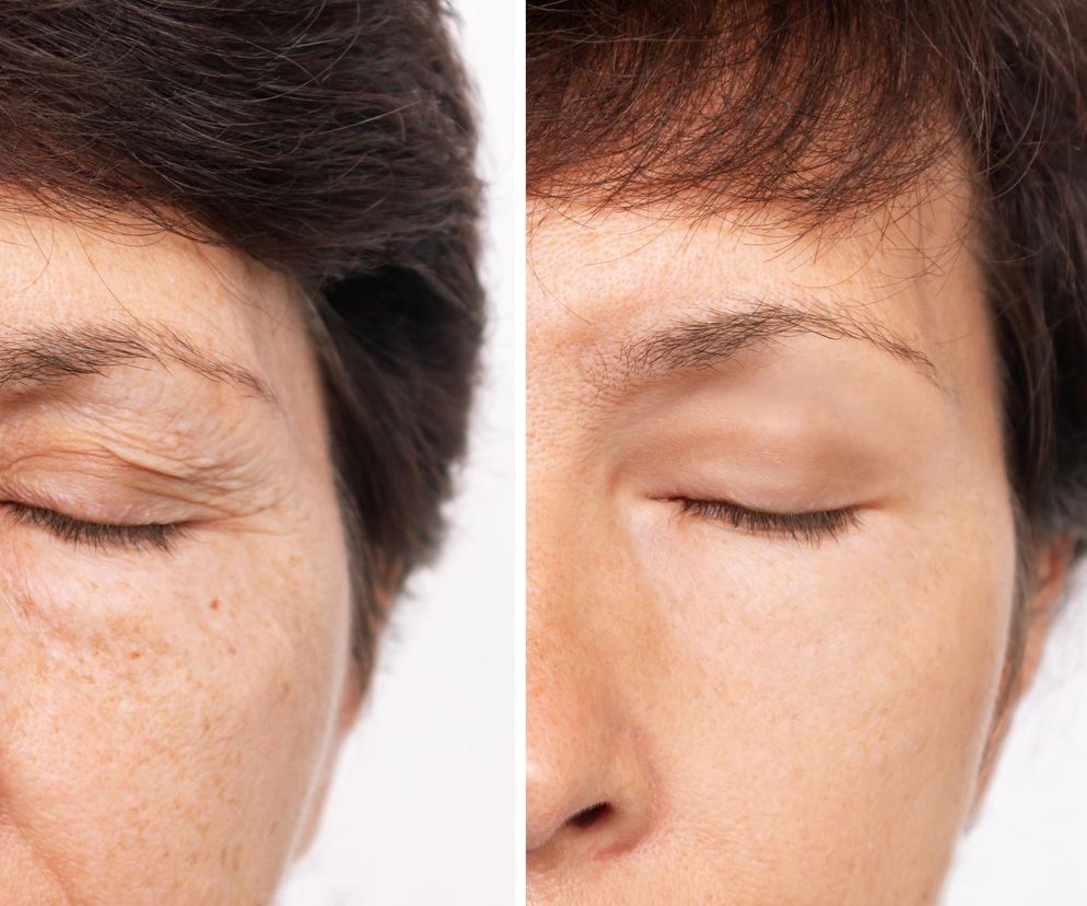 Napięta skóra w 10 minut? Działa jak luksusowy krem a nie kosztuje ani grosza