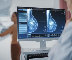 Nowe opcje leczenia dla kobiet z rakiem piersi. Nawet te gorzej rokujące mogą być skutecznie leczone