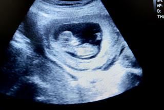 11 tydzień ciąży - USG