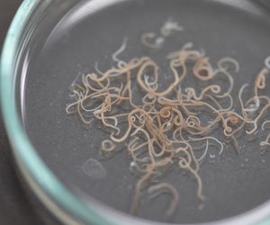 Glista ludzka - objawy i leczenie glistnicy. Jak uniknąć zakażenia glistą ludzką?