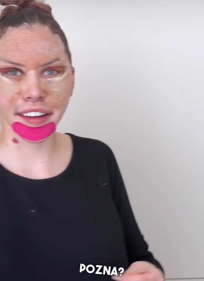 Julia Von Stein po operacji 
