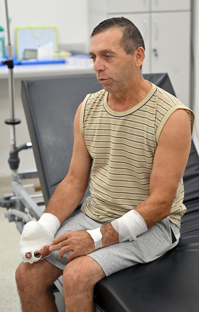 W 5 Klinicznym Szpitalu Wojskowym  Krakowie przyszyli panu Markowi kciuk