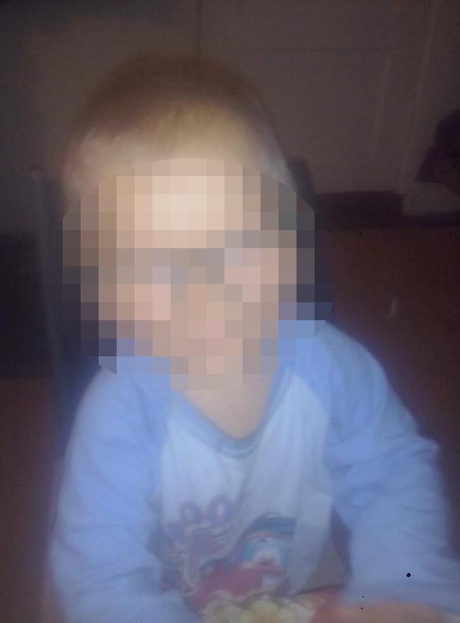 Matka obcięła nożyczkami palec 4-letniemu chłopcu