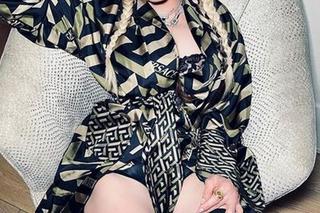 63-letnia Madonna pobita? Gwiazda opublikowała szokujące zdjęcia!