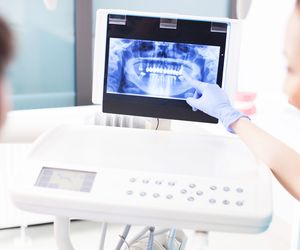 Torbiele zębopochodne: rodzaje, przyczyny, objawy, leczenie